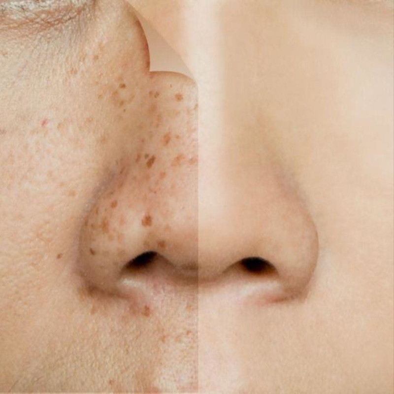 serum-correcteur-koura-cosmetics-3 serum-correcteur-koura-cosmetics-3